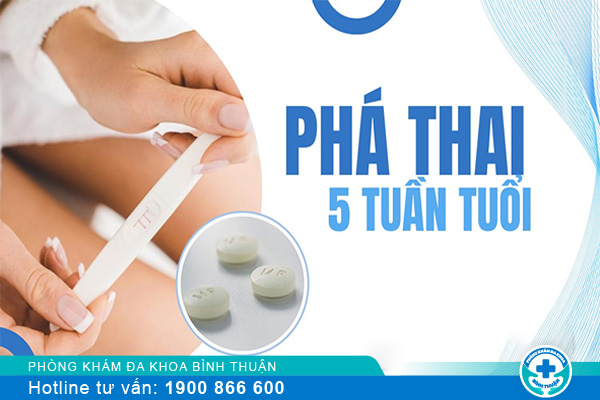 Cách phá thai 5 tuần an toàn - hiệu quả - không biến chứng